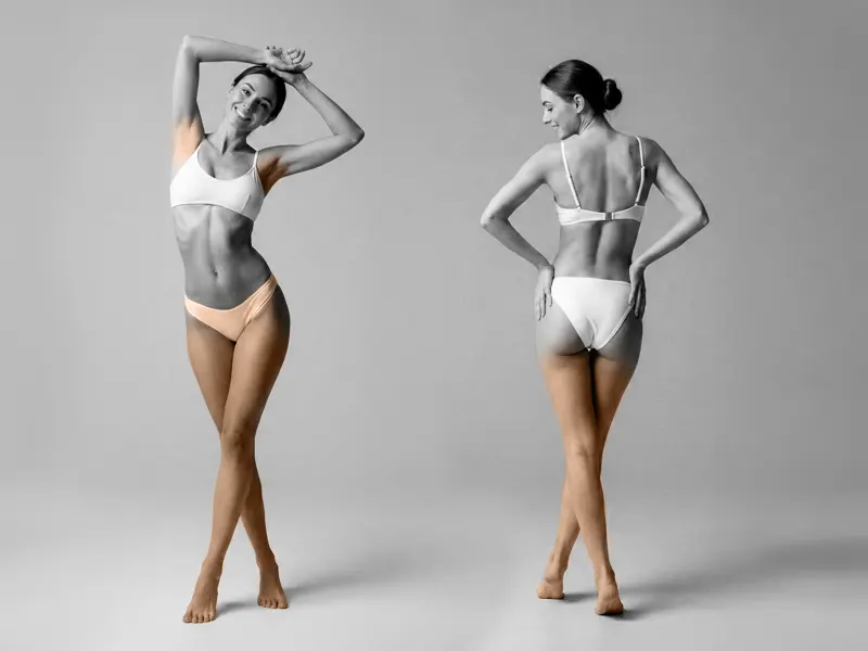 Női bikini és láb terület végleges lézeres szőrtelenítése, a kezelendő intim és lábterület vizuális bemutatása lézeres szőrtelenítő kezeléshez
