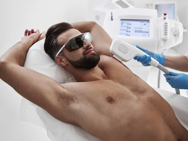 Végleges szőrtelenítés férfiaknak a hónalj területén modern diódalézer géppel, védőszemüvegben, professzionális kezelőszalonban